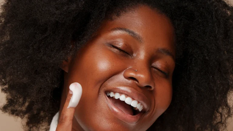 Hyperpigmentation in African Skin: Causes, Treatment & Prevention